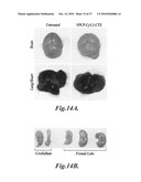 Nanoparticles for brain tumor imaging diagram and image