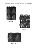 Nanoparticles for brain tumor imaging diagram and image