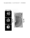 Nanoparticles for brain tumor imaging diagram and image