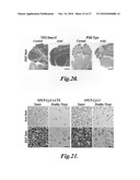 Nanoparticles for brain tumor imaging diagram and image