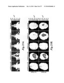 Nanoparticles for brain tumor imaging diagram and image