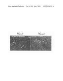 METHOD TO AMPLIFY CARDIAC STEM CELLS IN VITRO AND IN VIVO diagram and image