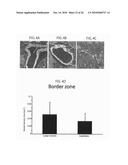 METHOD TO AMPLIFY CARDIAC STEM CELLS IN VITRO AND IN VIVO diagram and image