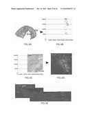 METHOD TO AMPLIFY CARDIAC STEM CELLS IN VITRO AND IN VIVO diagram and image