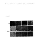 ROLE FOR SRY IN PARKINSON S DISEASE diagram and image