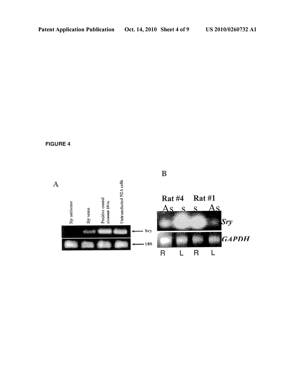 ROLE FOR SRY IN PARKINSON'S DISEASE - diagram, schematic, and image 05