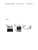 ROLE FOR SRY IN PARKINSON S DISEASE diagram and image