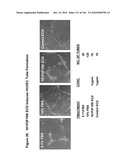 ANTIBODIES AND RELATED MOLECULES THAT BIND TO 161P2F10B PROTEINS diagram and image