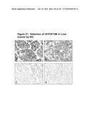 ANTIBODIES AND RELATED MOLECULES THAT BIND TO 161P2F10B PROTEINS diagram and image