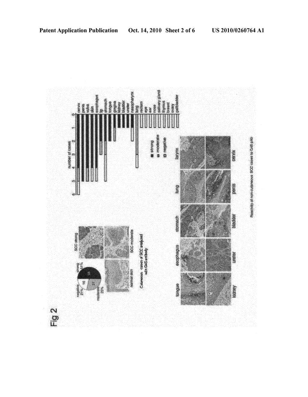 COMPOSITIONS AND METHODS FOR INHIBITING SQUAMOUS CELL CARCINOMA - diagram, schematic, and image 03