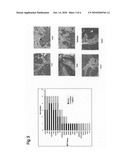 COMPOSITIONS AND METHODS FOR INHIBITING SQUAMOUS CELL CARCINOMA diagram and image