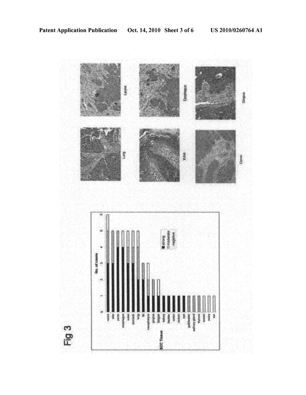 COMPOSITIONS AND METHODS FOR INHIBITING SQUAMOUS CELL CARCINOMA - diagram, schematic, and image 04