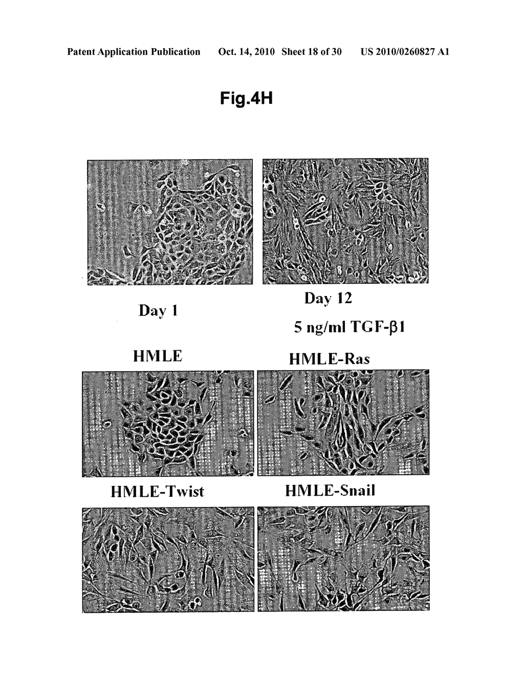 Methods of diagnosing, preventing and treating cancer metastasis - diagram, schematic, and image 19