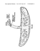 TISSUE MATRICES COMPRISING PLACENTAL STEM CELLS diagram and image