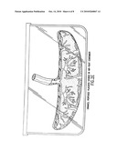 TISSUE MATRICES COMPRISING PLACENTAL STEM CELLS diagram and image