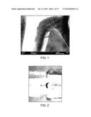 Method for loading nanoporous layers with therapeutic agent diagram and image