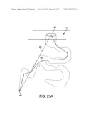 Method for loading nanoporous layers with therapeutic agent diagram and image