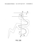 Method for loading nanoporous layers with therapeutic agent diagram and image