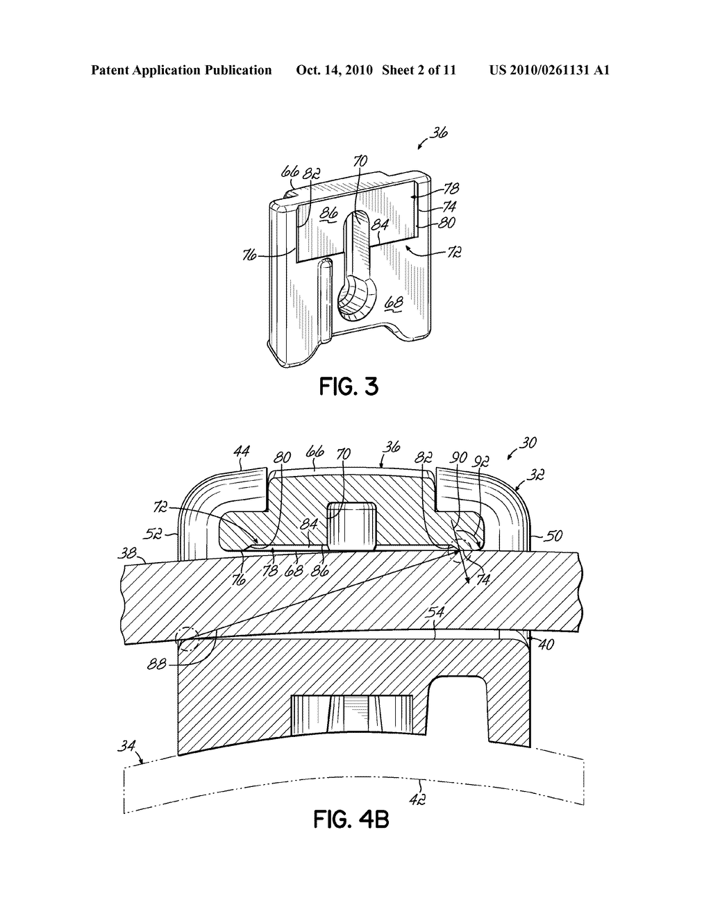 Orthodontic Bracket and Method of Correcting Malpositioned Teeth - diagram, schematic, and image 03