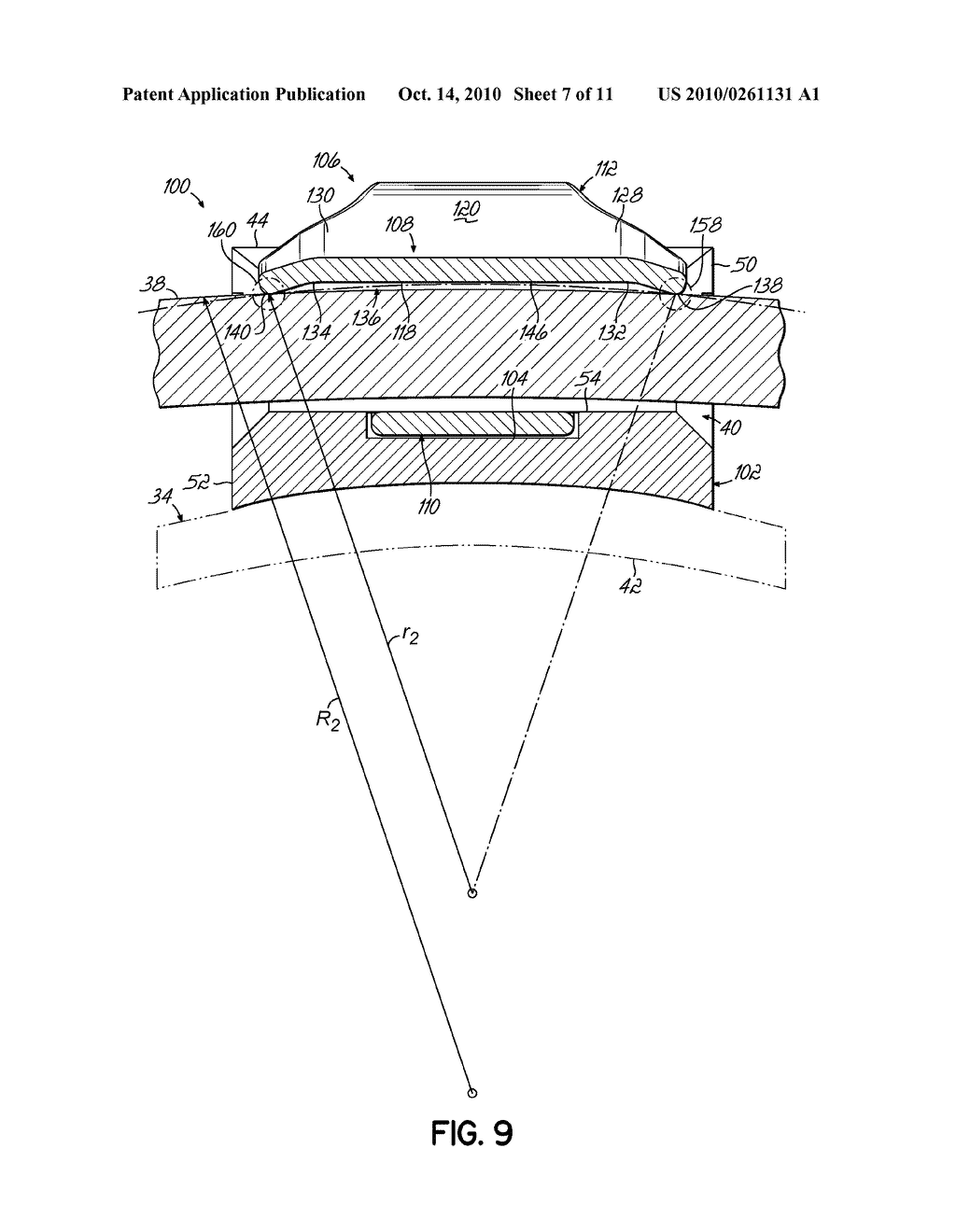 Orthodontic Bracket and Method of Correcting Malpositioned Teeth - diagram, schematic, and image 08