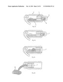 MIXING AND APPLICATION CAPSULE FOR PRODUCING A DENTAL PREPARATION diagram and image