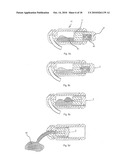 MIXING AND APPLICATION CAPSULE FOR PRODUCING A DENTAL PREPARATION diagram and image