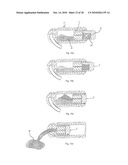 MIXING AND APPLICATION CAPSULE FOR PRODUCING A DENTAL PREPARATION diagram and image