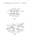 GOLF CLUB HEAD OR OTHER BALL STRIKING DEVICE HAVING STIFFENED FACE PORTION diagram and image