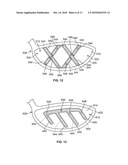 GOLF CLUB HEAD OR OTHER BALL STRIKING DEVICE HAVING STIFFENED FACE PORTION diagram and image