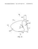 GOLF CLUB HEAD OR OTHER BALL STRIKING DEVICE HAVING STIFFENED FACE PORTION diagram and image