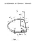 GOLF CLUB HEAD OR OTHER BALL STRIKING DEVICE HAVING STIFFENED FACE PORTION diagram and image