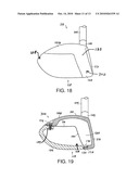 GOLF CLUB HEAD OR OTHER BALL STRIKING DEVICE HAVING STIFFENED FACE PORTION diagram and image