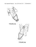 PORTABLE FOOT AND ANKLE EXERCISE APPARATUS AND ASSOCIATED METHODS diagram and image