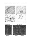 Use of a Granulin or a Granulin-Like Compound in the Therapy or Prophylaxis of Chronic Pains diagram and image