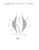 UTILIZATION OF MURAL THROMBUS FOR LOCAL DRUG DELIVERY INTO VASCULAR TISSUE diagram and image