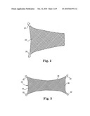 Surgical articles and methods for treating pelvic conditions diagram and image