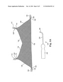 Surgical articles and methods for treating pelvic conditions diagram and image