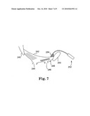 Surgical articles and methods for treating pelvic conditions diagram and image