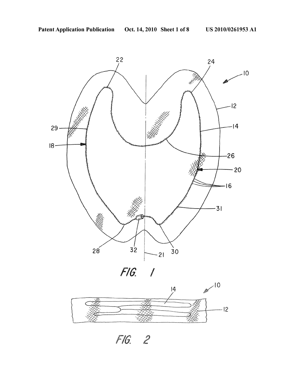 APPARATUS AND METHOD FOR PELVIC FLOOR REPAIR IN THE HUMAN FEMALE - diagram, schematic, and image 02