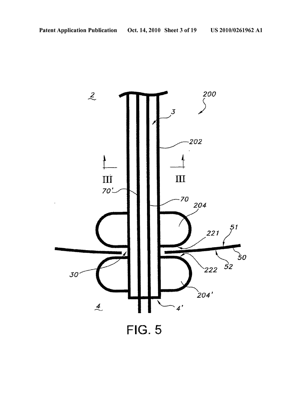 NATURAL ORIFICE TRANSLUMINAL ENDOSCOPIC SURGERY OVERTUBE AND METHOD OF INTRODUCING MULTIPLE ENDOSCOPES - diagram, schematic, and image 04