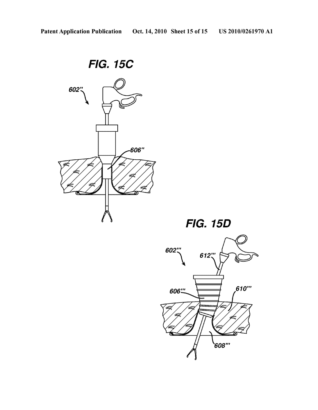 RETRACTOR WITH FLEXIBLE SLEEVE - diagram, schematic, and image 16