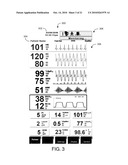 MODULAR PATIENT MONITOR diagram and image