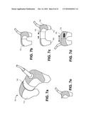 Universal Multiple Aperture Medical Ultrasound Probe diagram and image