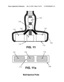 Universal Multiple Aperture Medical Ultrasound Probe diagram and image