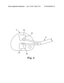 ANNULOPLASTY SIZERS FOR MINIMALLY INVASIVE PROCEDURES diagram and image