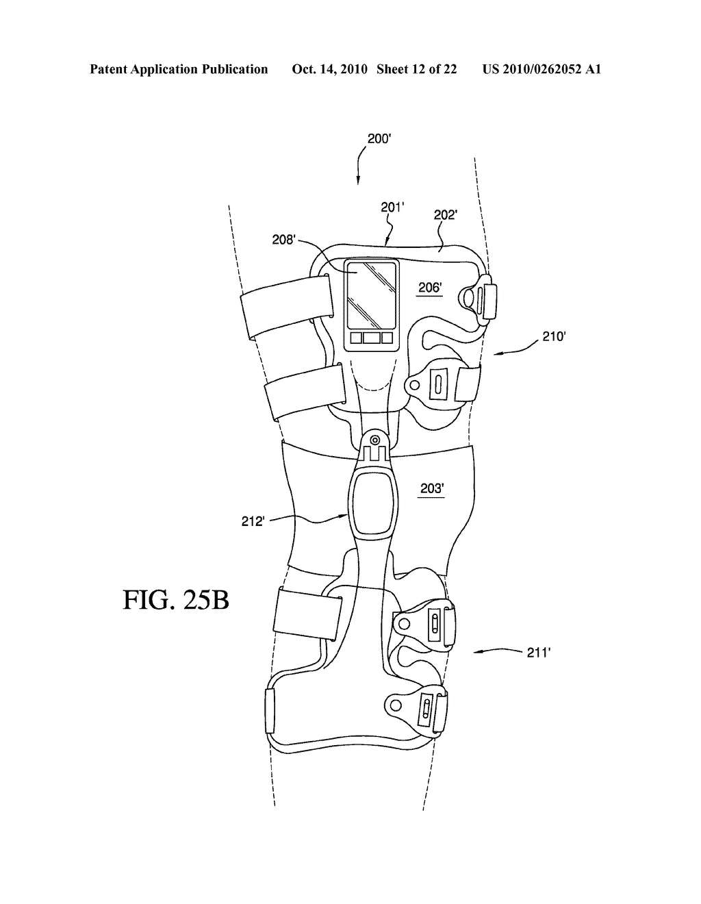 BRACING AND ELECTROSTIMULATION FOR ARTHRITIS - diagram, schematic, and image 13