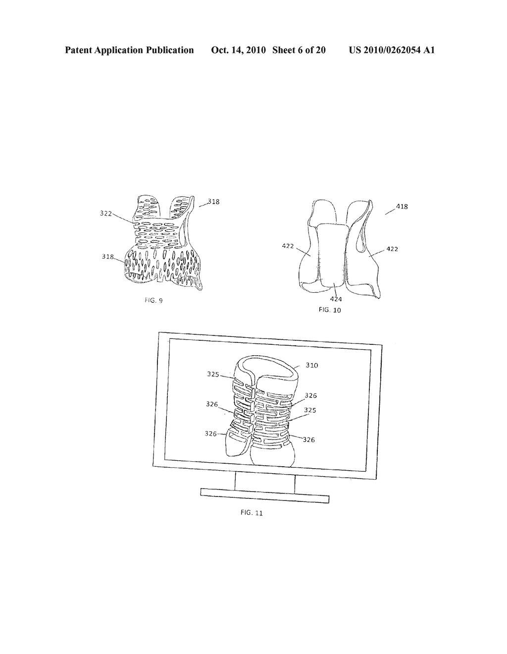 CUSTOM BRACES, CASTS AND DEVICES HAVING FENESTRATIONS AND METHODS FOR DESIGNING AND FABRICATING - diagram, schematic, and image 07