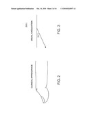 SPLINT COMPOSITION AND METHOD FOR USING SAME diagram and image