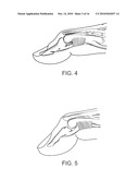 SPLINT COMPOSITION AND METHOD FOR USING SAME diagram and image