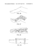 SPLINT COMPOSITION AND METHOD FOR USING SAME diagram and image